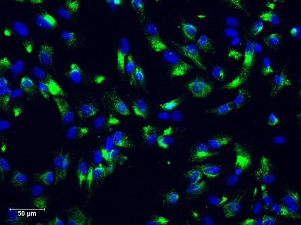 Human Astrocyte